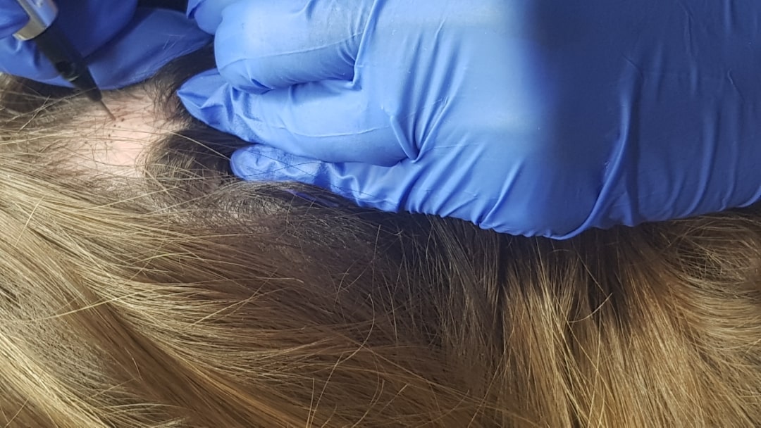 Mikropigmentacja włosów Białystok